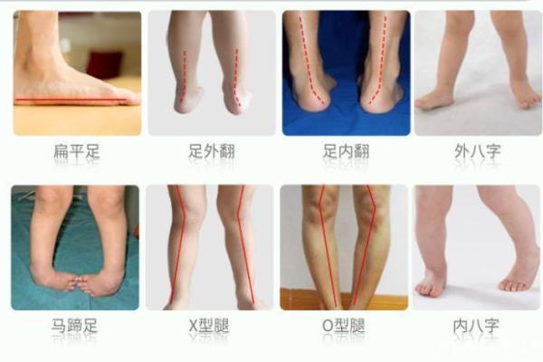 走路外八字的男人性格特点与心理分析