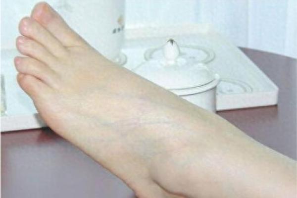 脚型和命运的关系：富贵命女性的足部标志