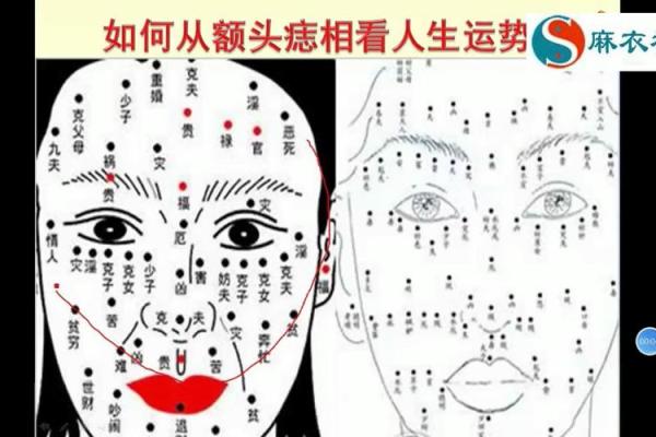 如何通过额头疤痕判断未来运势