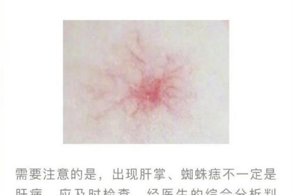 得肝病的家居风水禁忌与调理方法解析 得肝病的家居风水禁忌与调理方法解析